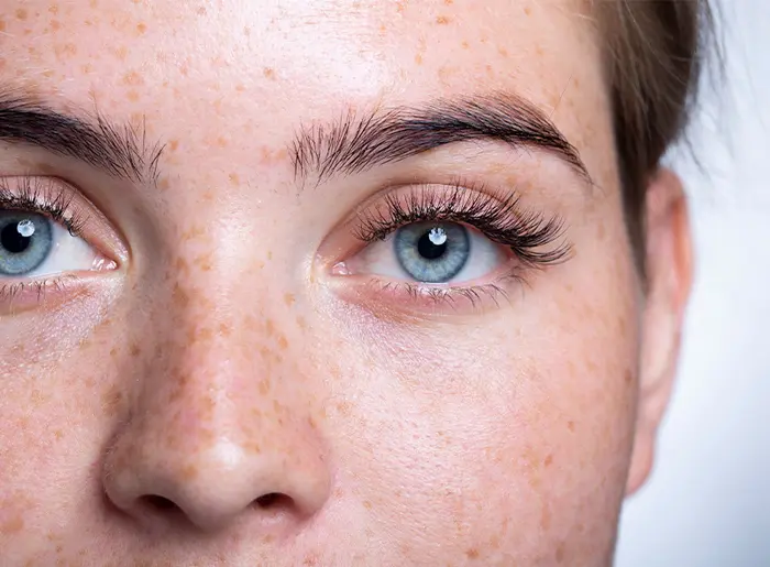SMILE Pro Augenlasern - Nahaufnahme eines Auges als Symbolbild für das minimalinvasive Verfahren ohne Flap mit schneller Heilung