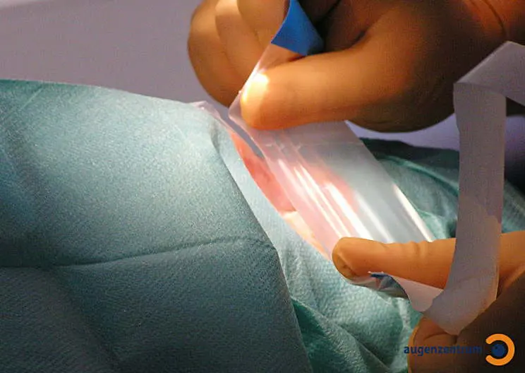 Die Lider werden beim Augenlasern/Lasik durch eine sterile Folie abgedeckt.