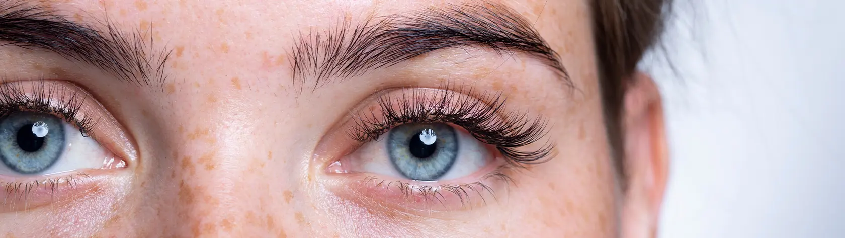 Blaue Augen einer Frau in Nahaufnahme, die bereits mit dem Augenlaser behandelt sind. 